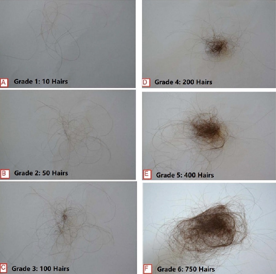 What Do 100 Strands of Hair Look Like? (With Photo) – Hairstyle Camp