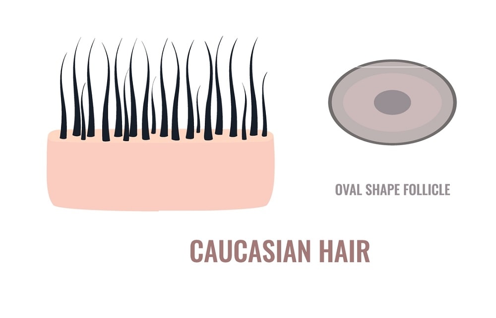 Caucasian hair characteristics - follicle shape
