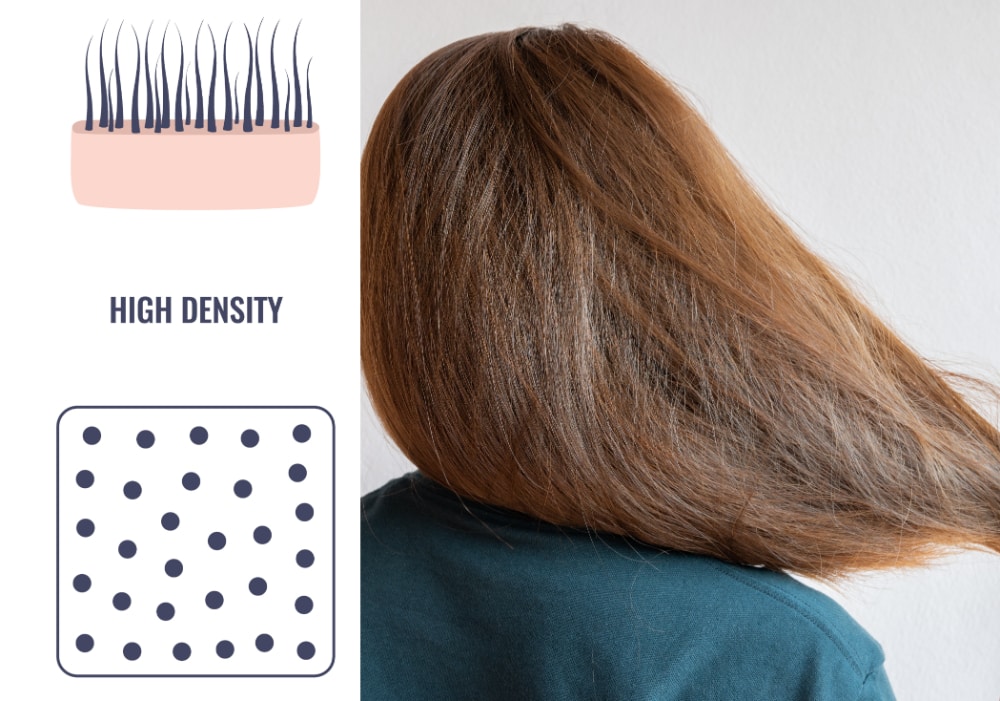 Caucasian hair characteristics - hair density