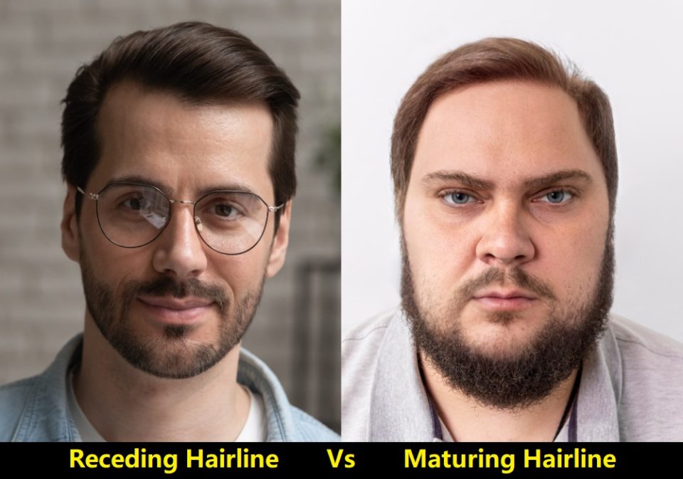 Differences Between Mature And Receding Hairlines 960x673 