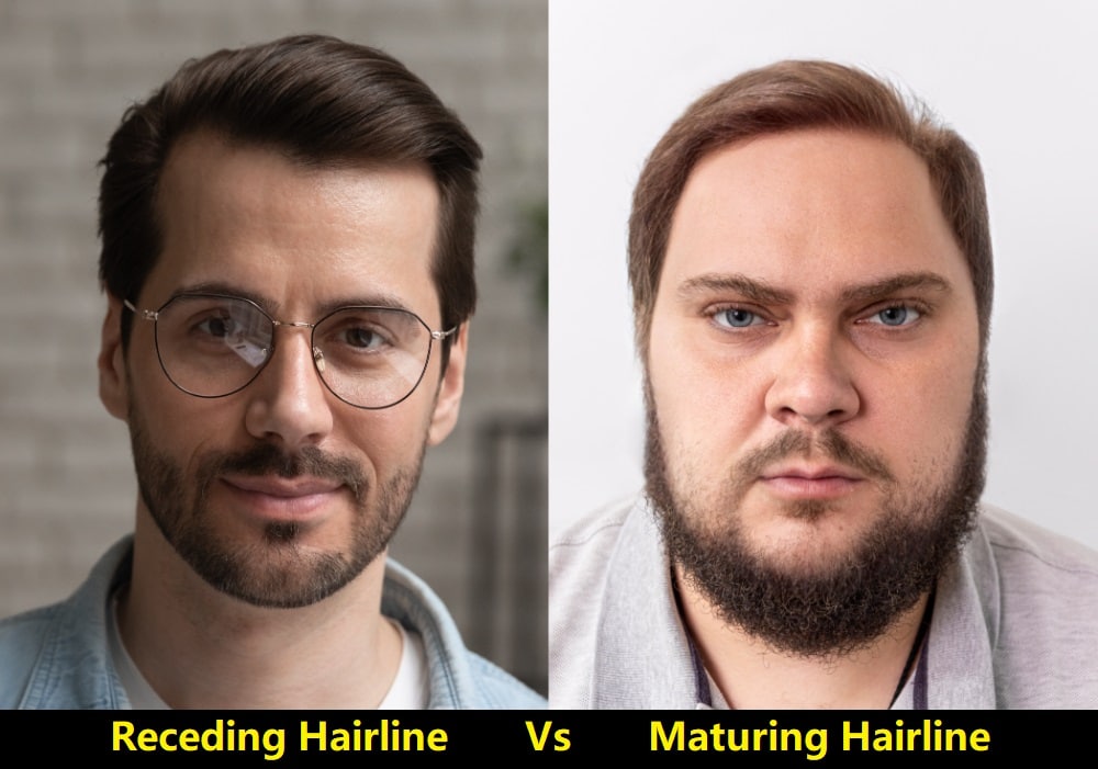 mature hairline vs a receding hairline