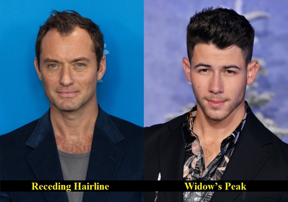 Widow’s Peak vs Receding Hairline