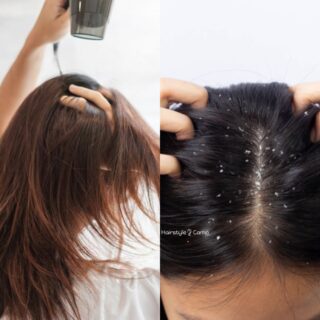 is hair dryer responsible for my dandruff