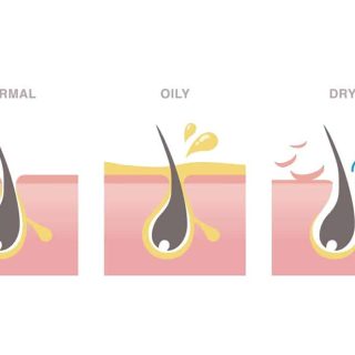 difference Between dry, oily and normal hair