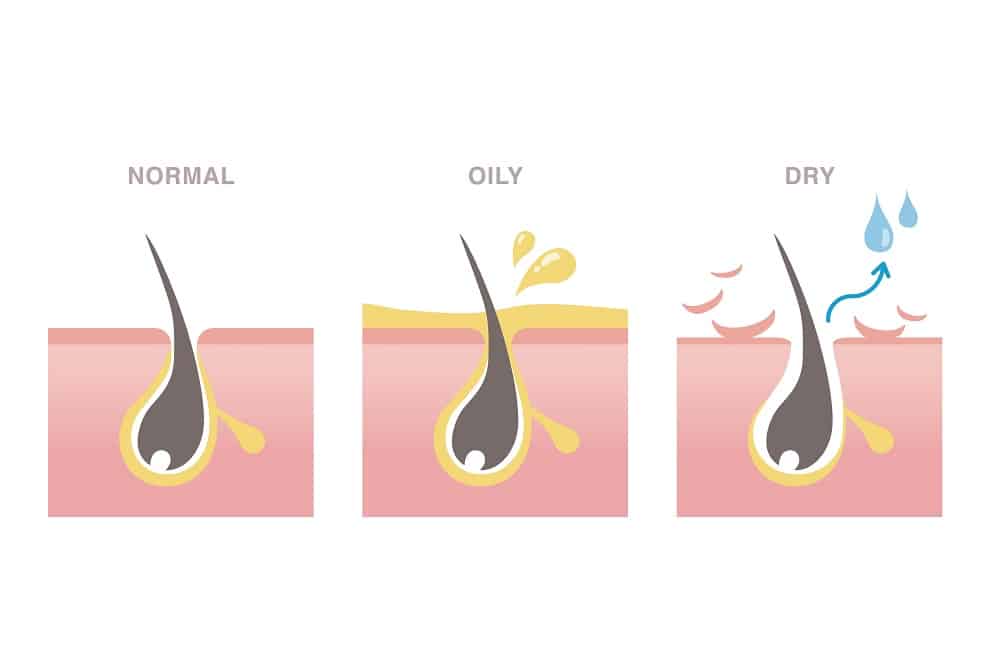 Dry Hair Vs. Oily Hair Vs. Normal Hair — Here's How to Tell Your Hair Type