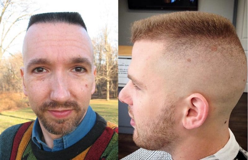 3. "Blue Buzz Cut: The Ultimate Statement Haircut" - wide 7