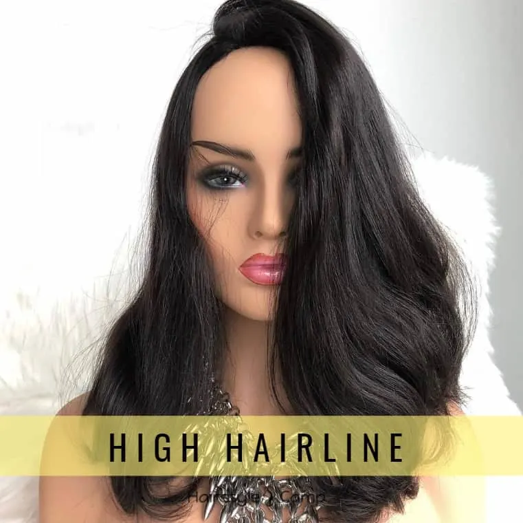 High hairline