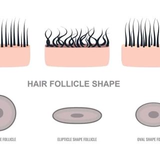 How To Change Hair Follicle Shape