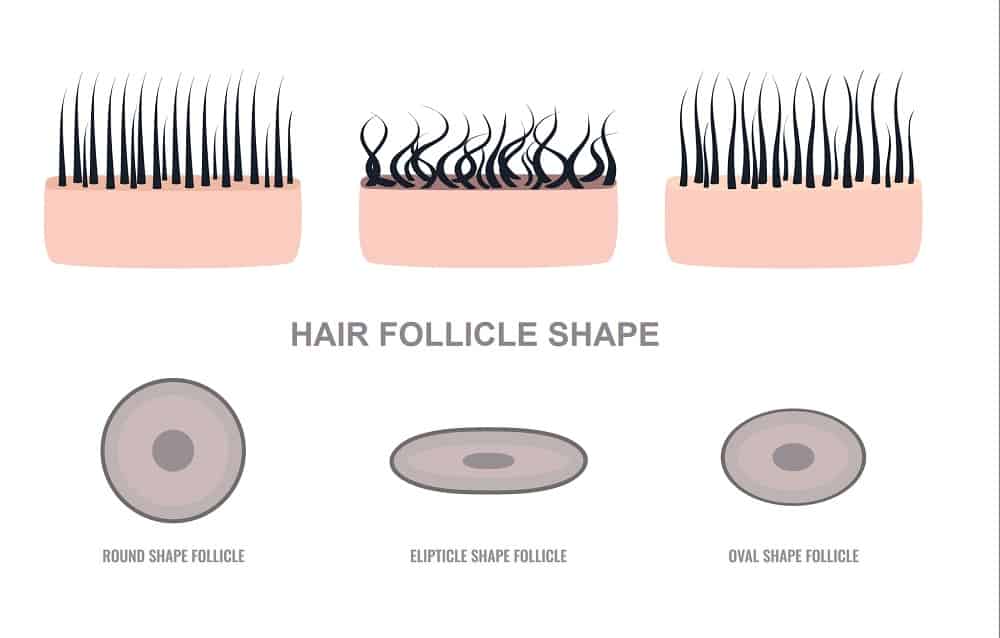 How To Change Hair Follicle Shape? – HairstyleCamp