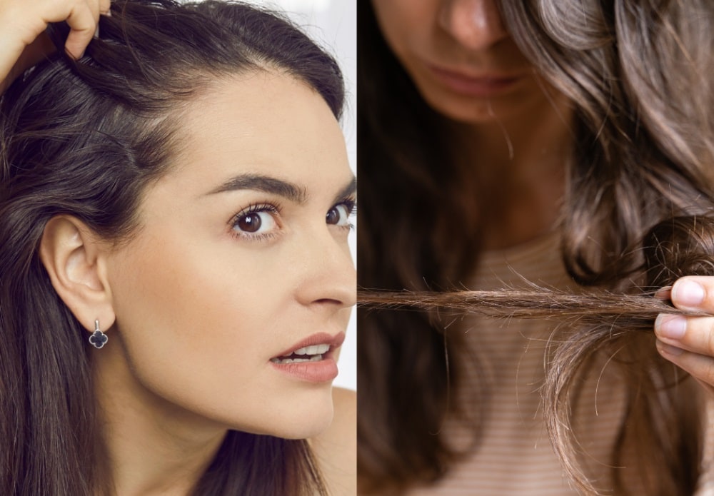 How To Know if You Have Thin Hair