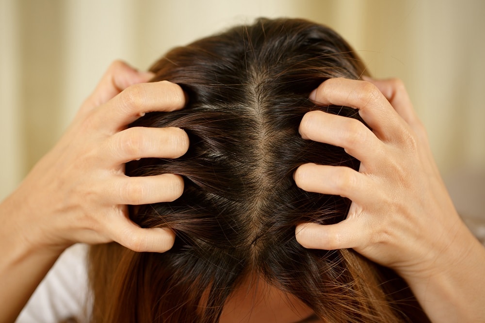 How To Tell if Your Hair Conditioner Is Expired or Went Bad - Scalp Irritation