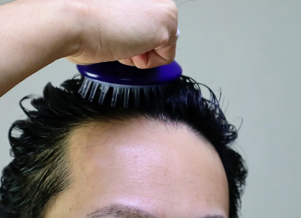How to Fix an M-shaped Hairline - Scalp Massage