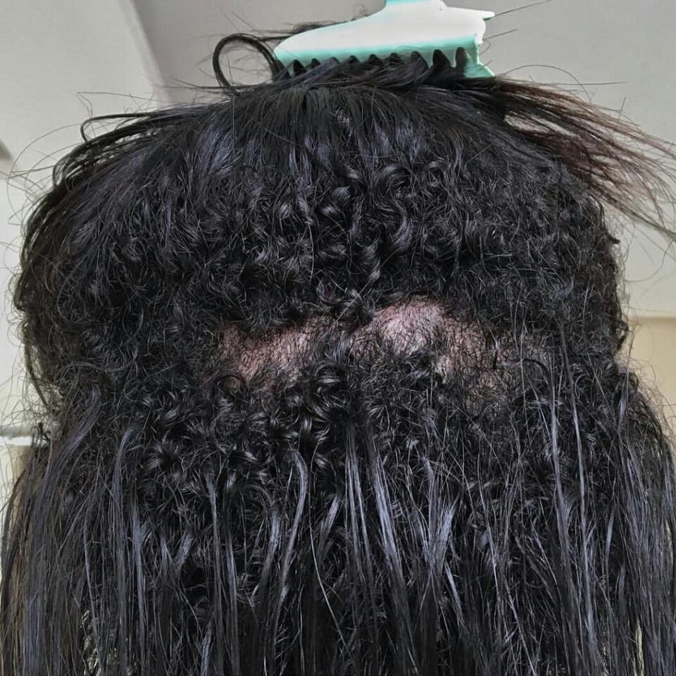3, 4, 6, 8 Months of Transitioning to Natural Hair: See What to Expect