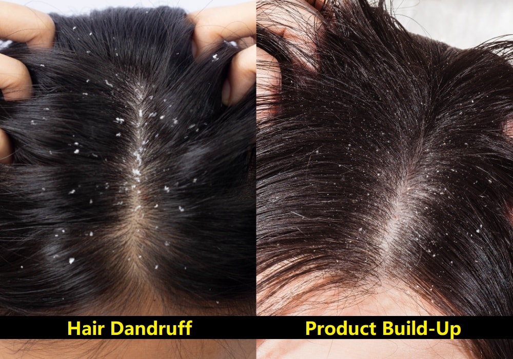 Product Build Up In Hair Vs Dandruff How To Tell The Difference