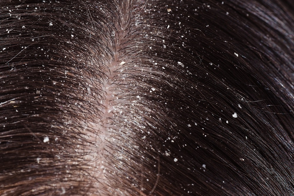 Causes of waxy hair - build-up