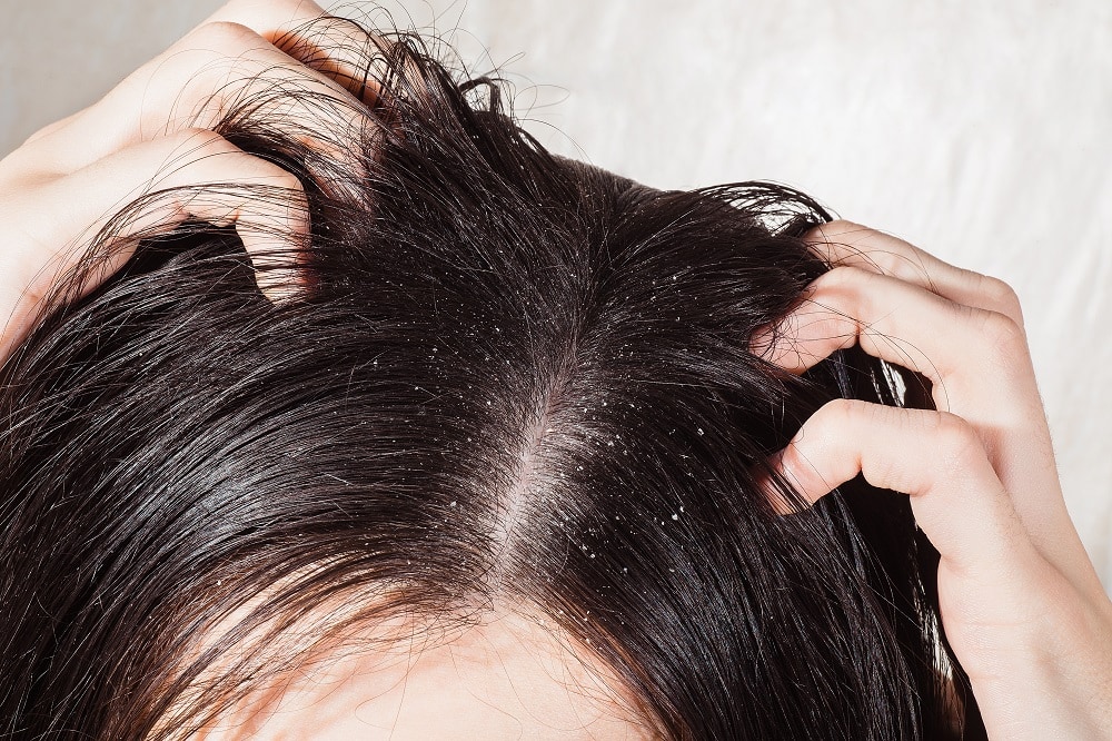 Signs of Product Buildup in Hair - Greasy Hair
