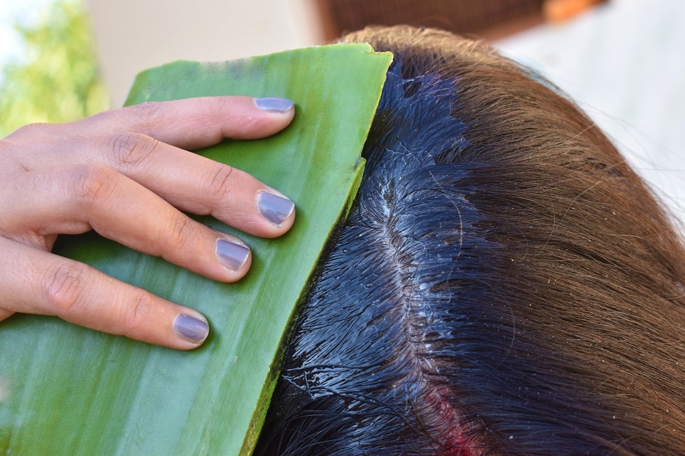 Ways to get rid of itchy scalp after death - aloe vera gel 