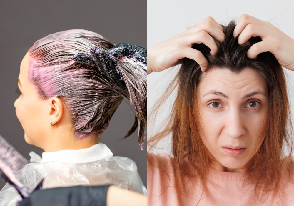 Reasons Why Hair Fall Out at the Roots After Dyeing