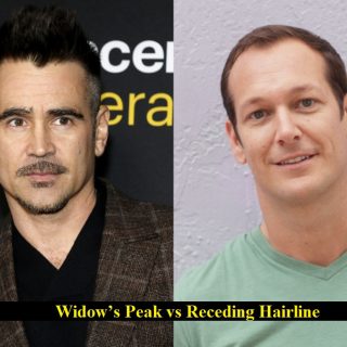 Differences Between a Widow’s Peak and a Receding Hairline