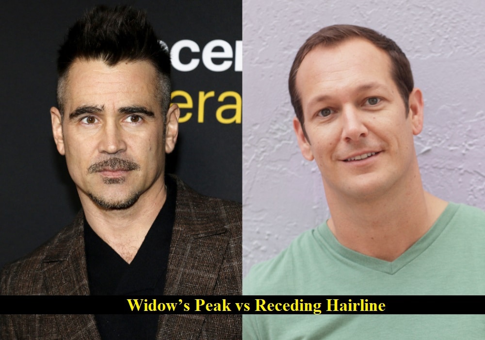 widow-s-peak-vs-receding-hairline-how-to-tell-the-difference