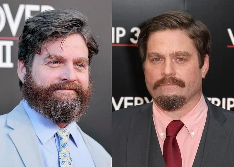 Zach Galifianakis Beard with Mustache