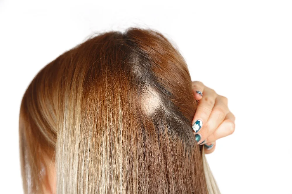 The Hair Loss Guide for Women Plus Regrowth Tips  Treatments  Allure