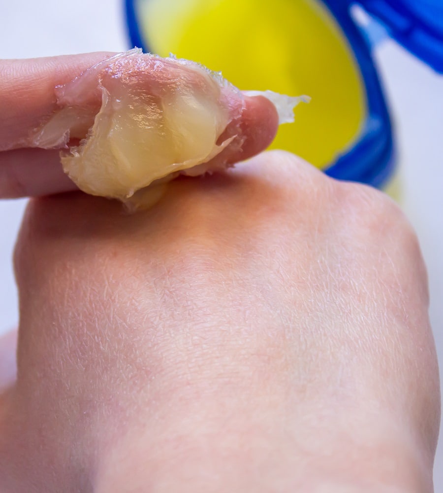 applying petroleum jelly to heal ripped skin from waxing