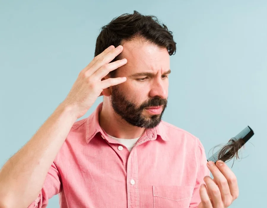 balding hair signs