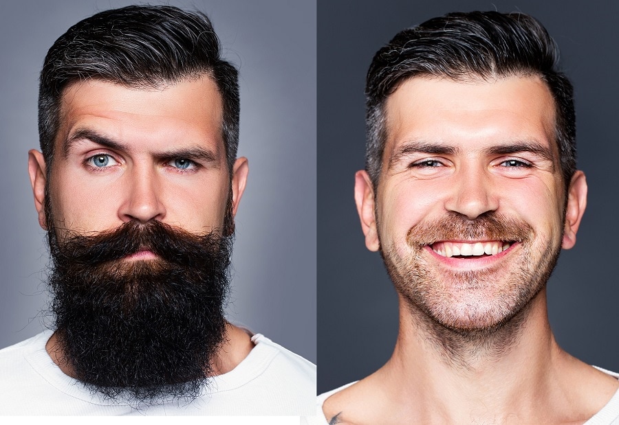 Bandholz beard before and after appearance