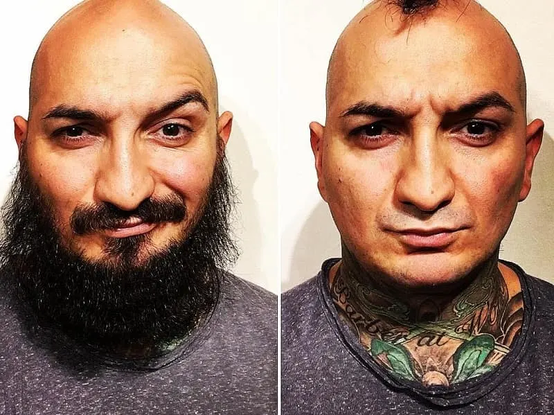 Before and after appearance of men's beards