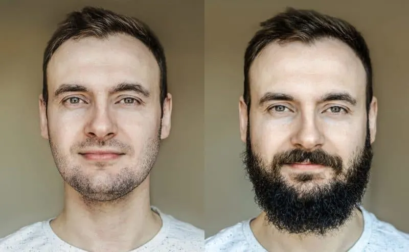 short hair and long patchy beard