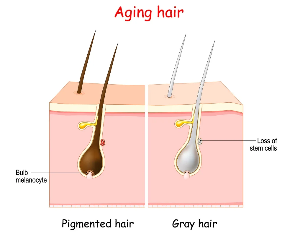 reason of hair color change with age