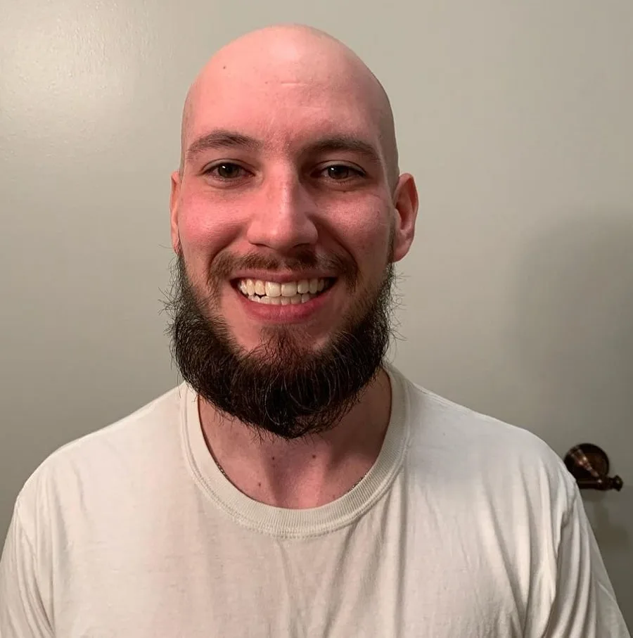 chin curtain beard for bald men