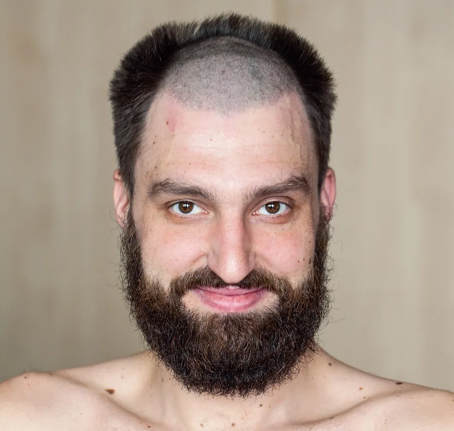crazy haircut for balding men