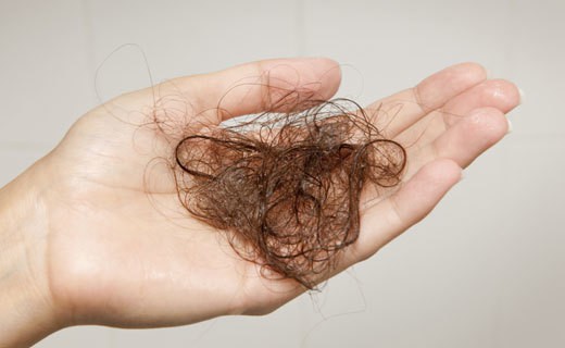  hair loss