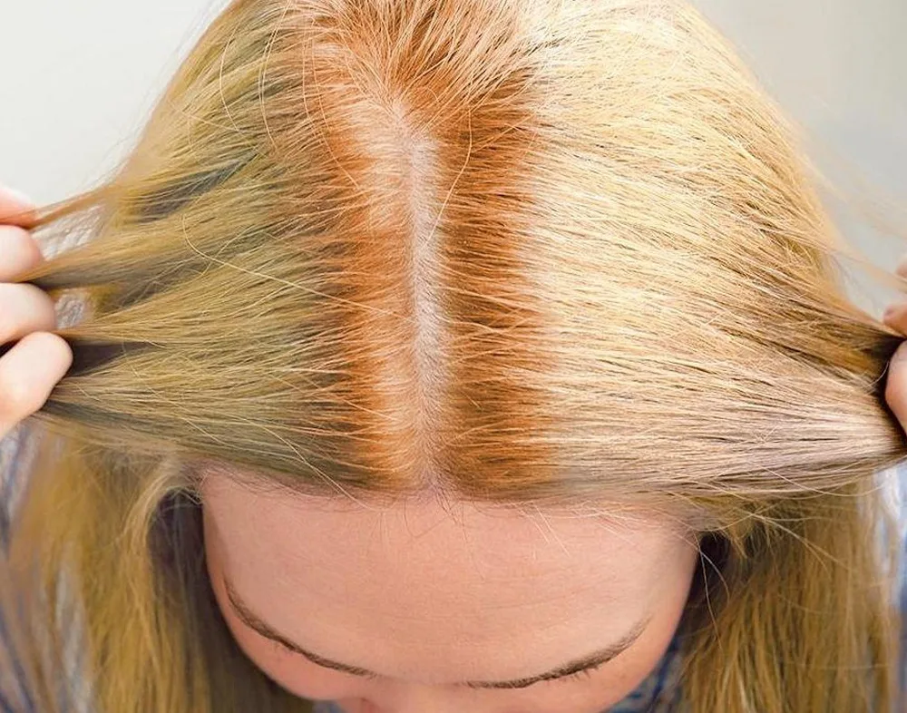 Why does dyed blonde hair turn red?