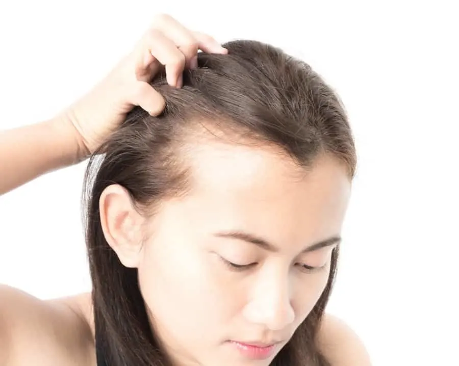 fluocinonide for hair loss