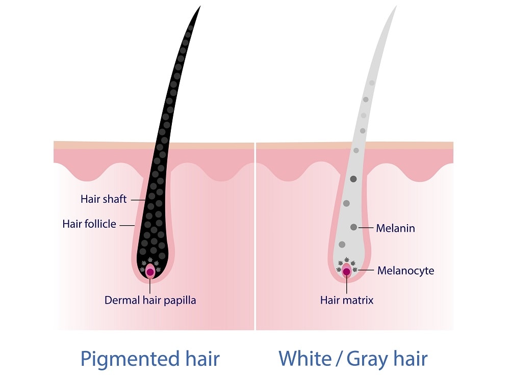 grey vs white hair - formation