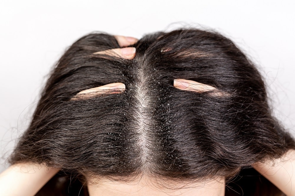 7 Concrete Signs Of Hair Product Build Up How To Fix It Quickly