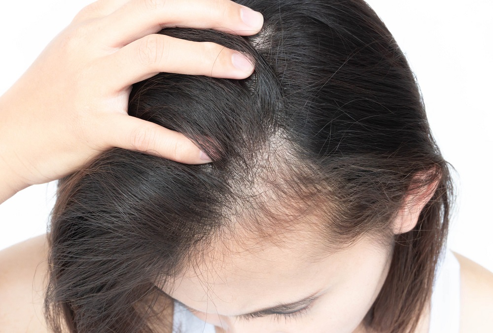hair stress can cause hair loss and thinning