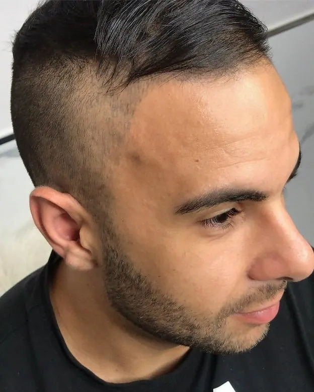 Side Swept Haircut for Men with Big Forehead Receding Hairline