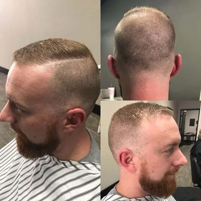 haircuts for balding crown