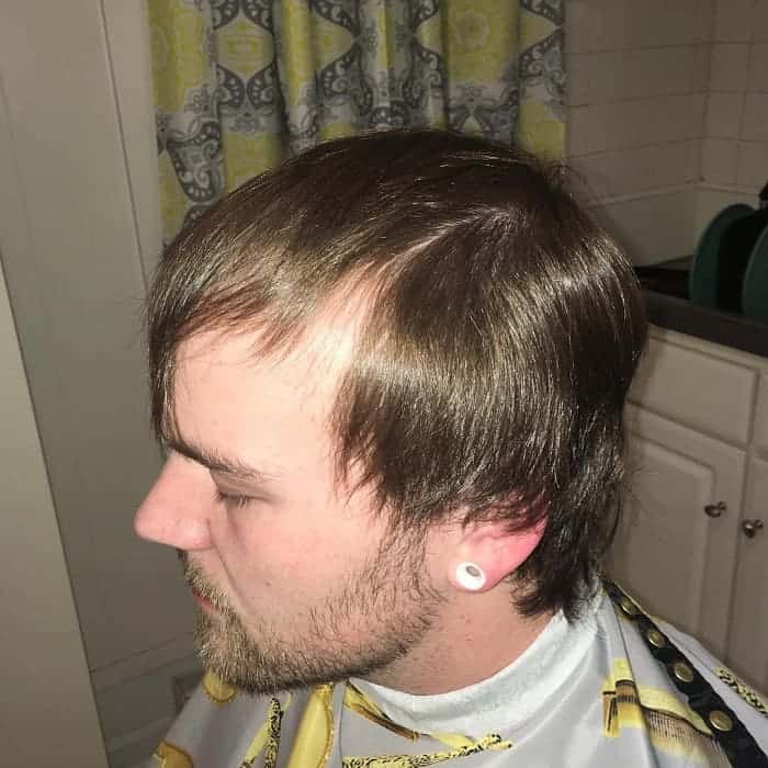 Aggregate 81+ hairstyle for balding crown male latest - in.eteachers