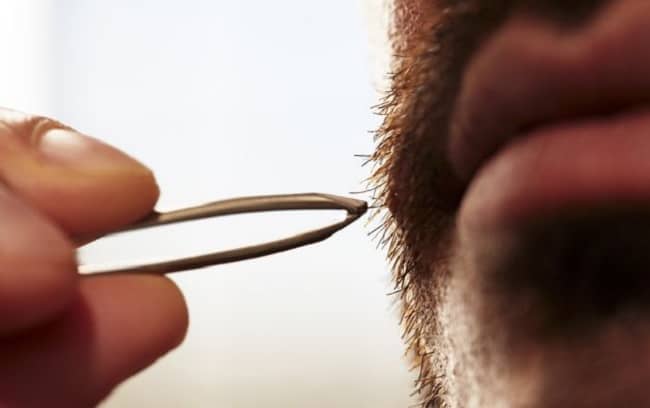 plucking of ingrown beard hair