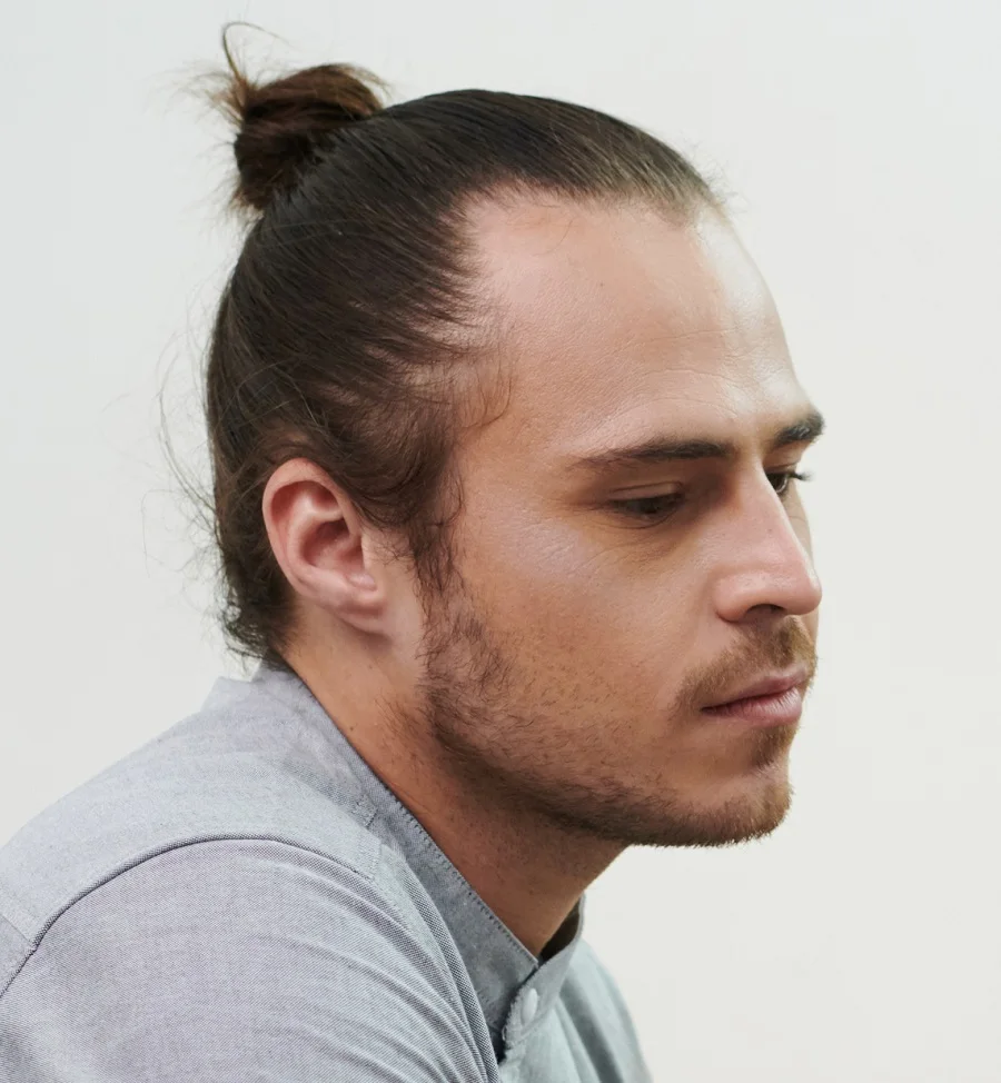 A man bun for a guy with long, balding hair