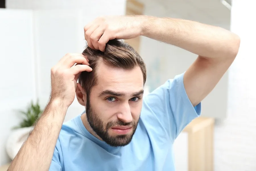 man with receding hairline