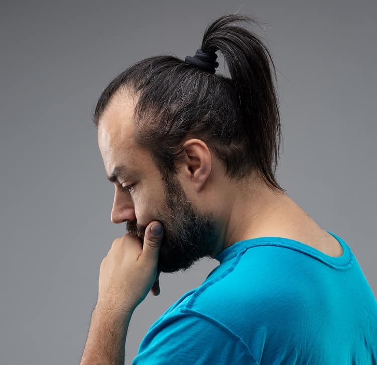 ponytail for balding man