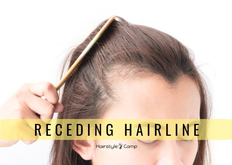receding hairline