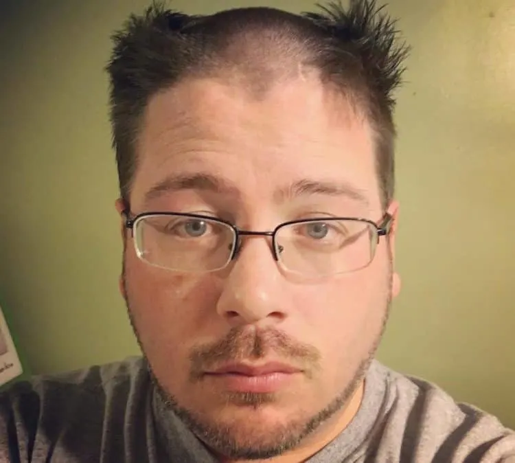 reverse mohawk