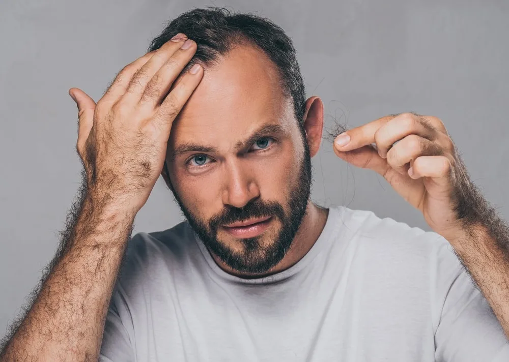 signs a man should stop dyeing hair - going bald